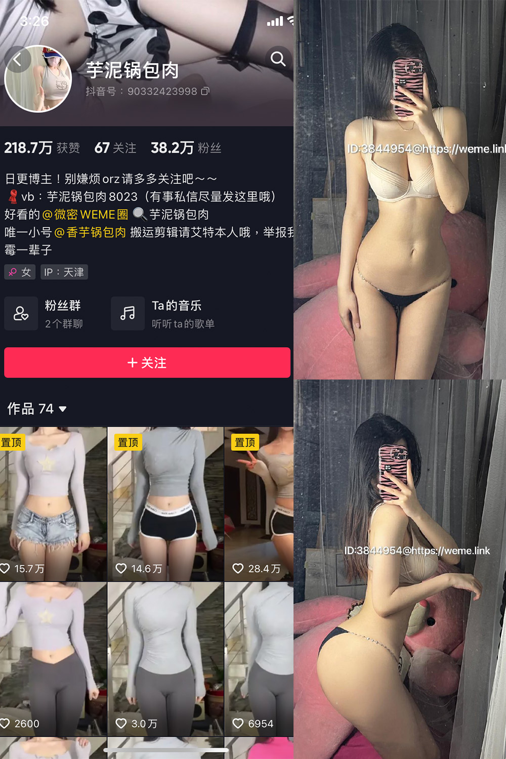 抖音 芋泥锅包肉 微密圈 NO.007期 【11P13V】