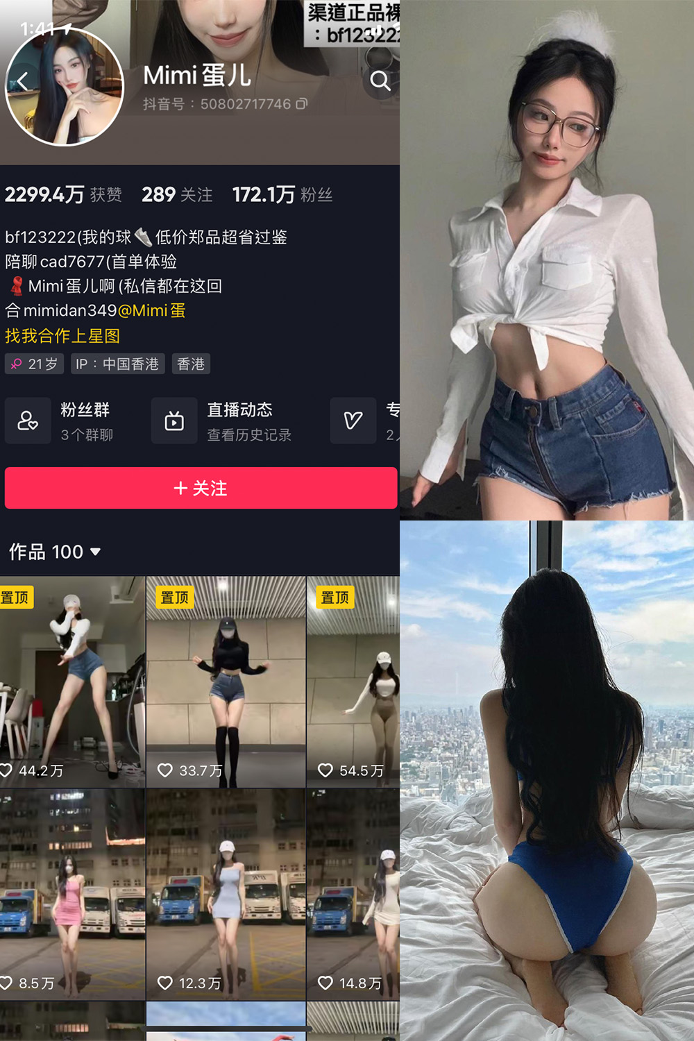 抖音 MImi蛋儿 微密圈 NO.002期 【8P1V】