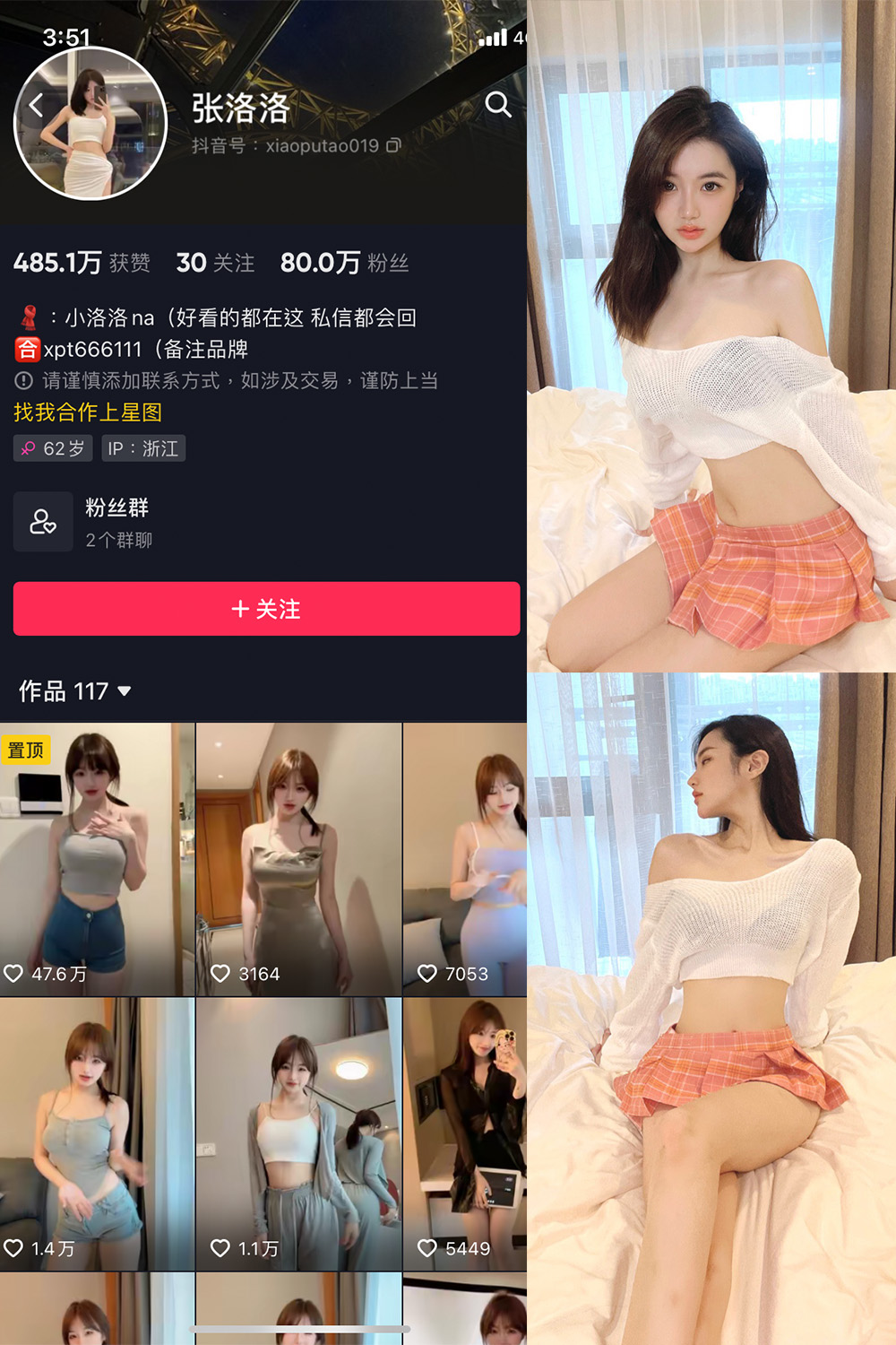 抖音 张洛洛 微密圈 NO.001期 【30P】