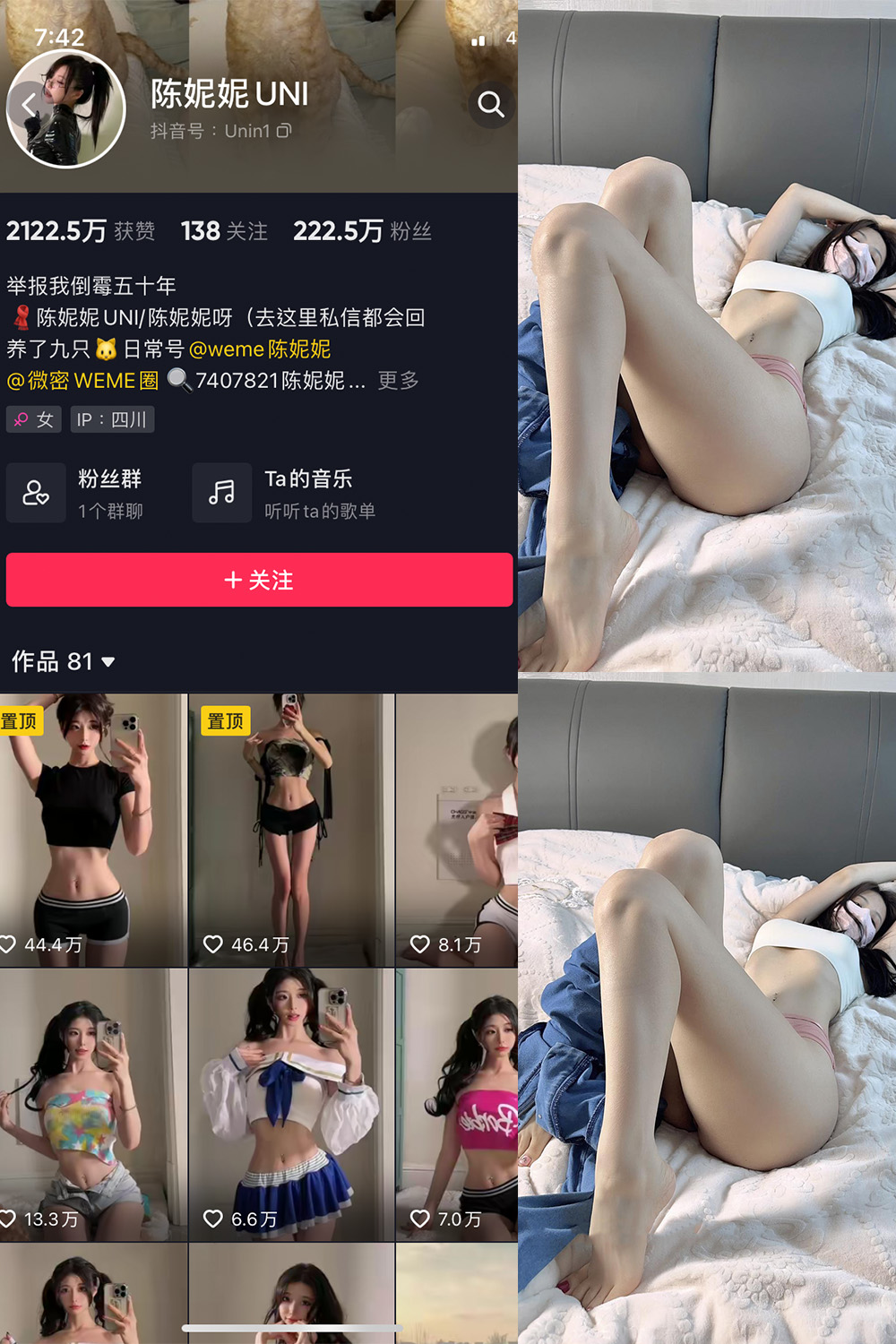 抖音 陈妮腻UNI 微密圈 NO.005期 【13P】