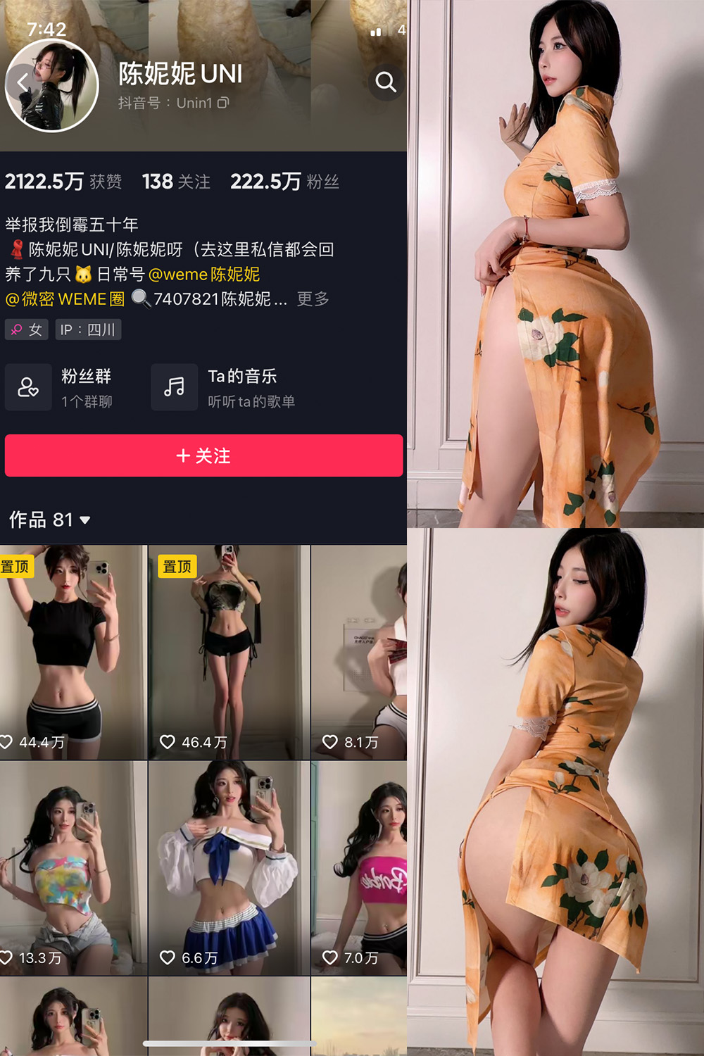 抖音 陈妮腻UNI 微密圈 NO.021期 【41P】