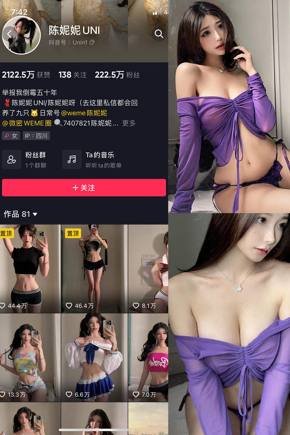 抖音 陈妮腻UNI 微密圈 NO.072期 【21P1V】